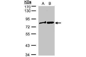 WB Image Sample(30 ug whole cell lysate) A: MOLT4 , B: Raji , 7. (DVL2 anticorps  (Internal Region))