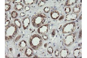 Image no. 1 for anti-TAP Binding Protein-Like (TAPBPL) antibody (ABIN1501300)