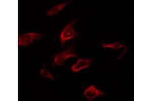 ABIN6267281 staining Hela by IF/ICC. (RAF1 anticorps  (pSer259))