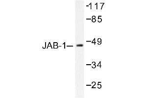 Image no. 1 for anti-COP9 Signalosome Complex Subunit 3 (COPS3) antibody (ABIN265485) (COPS3 anticorps)
