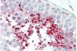 Huma Testis: Formalin-Fixed, Paraffin-Embedded (FFPE)