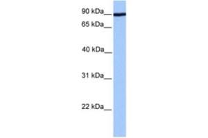 Western Blotting (WB) image for anti-ADAM Metallopeptidase Domain 2 (ADAM2) antibody (ABIN2463573) (ADAM2 anticorps)