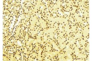 ABIN6268682 at 1/100 staining Mouse liver tissue by IHC-P. (BAG1 anticorps  (N-Term))