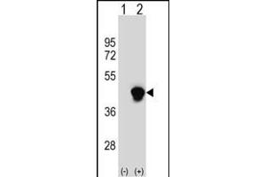 Western blot analysis of PECI (arrow) using rabbit polyclonal PECI Antibody (C-term) (ABIN652636 and ABIN2842426). (PECI/ECI2 anticorps  (C-Term))