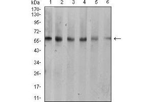 Western blot analysis using KRT10 mouse mAb against A431 (1), C6 (2), COS7 (3), Jurkat (4), NIH/3T3 (5), and HEK293 (6) cell lysate.