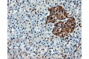 Immunohistochemical staining of paraffin-embedded liver tissue using anti-HSPA1Amouse monoclonal antibody. (HSP70 1A anticorps)