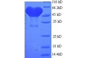 SDS-PAGE (SDS) image for Alcohol Dehydrogenase 1B (Class I), beta Polypeptide (ADH1B) (AA 2-375) protein (His-SUMO Tag) (ABIN5708999)