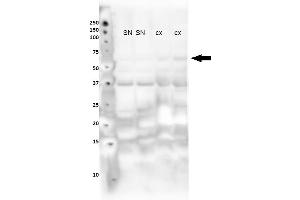 Lanes : Lane 1: Nuclear fraction from mouse substantia nigra Lane 2: Nuclear fraction from mouse substantia nigra Lane 3: Nuclear fraction from mouse cortex Lane 4: Nuclear fraction from mouse cortex Primary Antibody Dilution :  1:400   Secondary Antibody : Goat anti rabbit-HRP  Secondary Antibody Dilution :  1:10,000  Gene Name : NR4A2  Submitted by : Sorce Silvia, University of Zurich (NR4A2 anticorps  (N-Term))