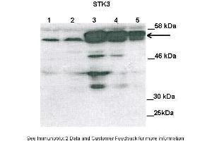 Lanes:   Lane1: 100ug untransfected COS-7 lysate Lane2: 100ug mock transfected Cos-7 lysate Lane3: 100ug STK3 transfected Cos-7 lysate Lane4: 50 ug STK3 transfected Cos-7 lysate Lane5: 25 ug STK3 transfected Cos-7 lysate  Primary Antibody Dilution:   1:2000  Secondary Antibody:   Anti-rabbit HRP  Secondary Antibody Dilution:   1:5000  Gene Name:   STK3  Submitted by:   Anonymous