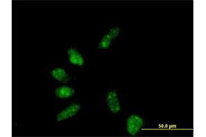 Immunofluorescence of purified MaxPab antibody to GTF2B on HeLa cell. (GTF2B anticorps  (AA 1-316))