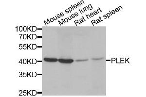 Western blot analysis of extracts of various cell lines, using PLEK antibody. (Pleckstrin anticorps)