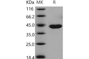 Western Blotting (WB) image for Carboxypeptidase A1 (Pancreatic) (CPA1) (Active) protein (His tag) (ABIN7194598)