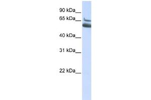 WB Suggested Anti-ALOX15B Antibody Titration:  0. (ALOX15B anticorps  (N-Term))