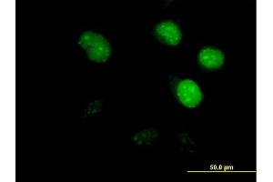 Immunofluorescence of purified MaxPab antibody to CDCA8 on HeLa cell. (CDCA8 anticorps  (AA 1-280))