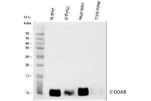 anti-S100 Calcium Binding Protein A8 (S100A8) (AA 2-89) antibody