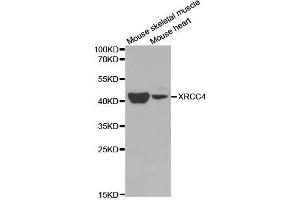 Western blot analysis of extracts of various cell lines, using XRCC4 antibody. (XRCC4 anticorps  (AA 1-336))