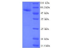 SDS-PAGE (SDS) image for Cytosolic Iron-Sulfur Protein Assembly 1 (CIAO1) (AA 1-339), (full length) protein (His-SUMO Tag) (ABIN5709287)