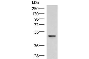 Western blot analysis of Human fetal liver tissue lysate using RMDN2 Polyclonal Antibody at dilution of 1:750 (FAM82A1 anticorps)