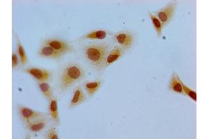 Immunocytochemistry analysis of Hela cells using ABIN7139607 at dilution of 1:100