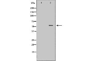 Western blot analysis of 293T whole cell lysates, using TFCP2 Antibody. (TFCP2 anticorps  (Internal Region))