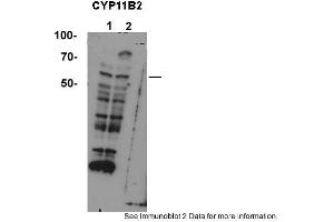 Sample type: 1. (CYP11B2 anticorps  (Middle Region))