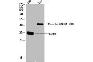 Western Blot analysis of 293 cells using Phospho-GSK3β (S9) Polyclonal Antibody (GSK3 beta anticorps  (pSer9))