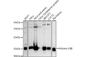Western blot analysis of extracts of various cell lines, using Histone H2B antibody (ABIN3015764, ABIN3015765, ABIN3015766 and ABIN6219109) at 1:1000 dilution. (Histone H2B anticorps  (AA 1-126))