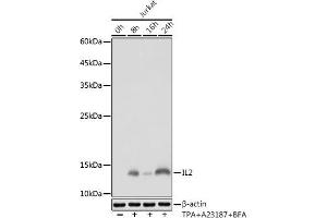 Western blot analysis of extracts of Jurkat cells, using IL2 antibody (ABIN7267993) at 1:1000 dilution. (IL-2 anticorps)