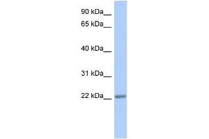 WB Suggested Anti-TRAPPC5 Antibody Titration: 0.