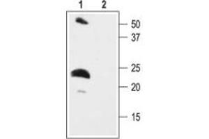 Western blot analysis of rat heart membranes: - 1. (KCNE2 anticorps  (C-Term, Intracellular))