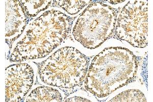 ABIN6260488 and ABIN6273998 at 1/100 staining Rat testis tissue by IHC-P.