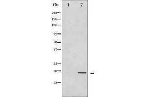Western blot analysis of Synuclein- alpha phosphorylation expression in Etoposide treated 293 whole cell lysates,The lane on the left is treated with the antigen-specific peptide. (SNCA anticorps  (pTyr133))