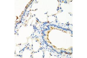 Immunohistochemistry of paraffin-embedded rat lung using RGS5 antibody (ABIN6130676, ABIN6146924, ABIN6146925 and ABIN6222790) at dilution of 1:100 (40x lens).