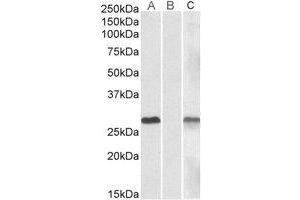 Lane A: AP23775PU-N 1µg/ml) staining of HEK293 overexpressing Human DYDC1 lysate (10µg protein in RIPA buffer). (DYDC1 anticorps  (Internal Region))