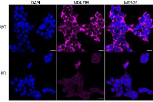 Immunocytochemical staining of HeLa cells using NDUFB9 antibody (ABIN7799553), 1:1,000), Top panel: wild-type (WT), Bottom panal: NDUFB9 shRNA knockdown (KD).