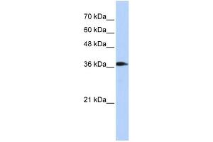 WB Suggested Anti-ATP6V0D2 Antibody Titration: 0.