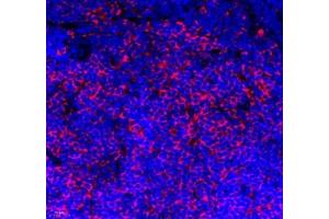 Immunofluorescence of paraffin embedded mouse lymph node using IL-27A (ABIN7074367) at dilution of 1: 800 (400x lens)
