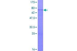 Image no. 1 for Carboxypeptidase A3 (Mast Cell) (CPA3) (AA 1-417) protein (GST tag) (ABIN1350169)
