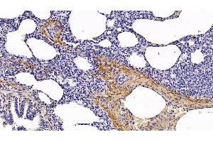 Detection of COL1a1 in Human Lung Tissue using Monoclonal Antibody to Collagen Type I Alpha 1 (COL1a1)