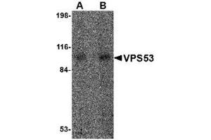 Western blot analysis of VPS53 in 293 cell lysate with VPS53 antibody at (A) 0. (VPS53 anticorps  (Center))