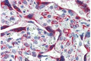 Placenta, Human: Formalin-Fixed, Paraffin-Embedded (FFPE)