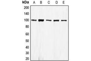 Western blot analysis of E Cadherin expression in HEK293T (A), A431 (B), MCF7 (C), mouse kidney (D), rat kidney (E) whole cell lysates.