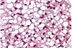 Mouse Adipose: Formalin-Fixed, Paraffin-Embedded (FFPE)