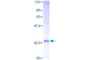 Image no. 1 for Synovial Sarcoma Translocation Gene On Chromosome 18-Like 2 (SS18L2) (AA 1-77) protein (GST tag) (ABIN1321381)
