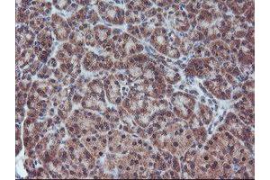 Image no. 10 for anti-Fragile X Mental Retardation 1 (FMR1) (AA 26-279) antibody (ABIN1491292)