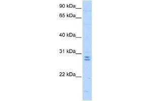 Western Blot showing MED4 antibody used at a concentration of 0.