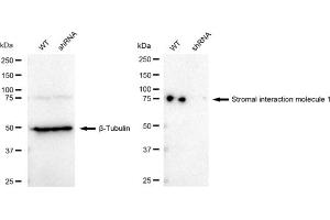 Western blotting analysis using Stromal interaction molecule 1 antibody (ABIN7800445). (Recombinant STIM1 anticorps)