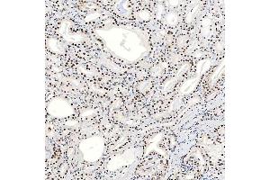 IHC analysis of SNRNP40 using anti-SNRNP40 antibody (ABIN7601719). (SNRNP40 anticorps  (AA 43-357))