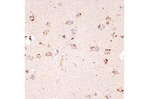 Immunohistochemistry of paraffin-embedded human brain using Ephrin  Rabbit mAb (ABIN7266976) at dilution of 1:100 (40x lens).