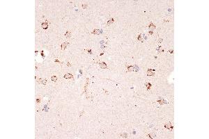 Immunohistochemistry of paraffin-embedded human brain using Ephrin  Rabbit mAb (ABIN7266976) at dilution of 1:100 (40x lens). (Ephrin A1 anticorps)